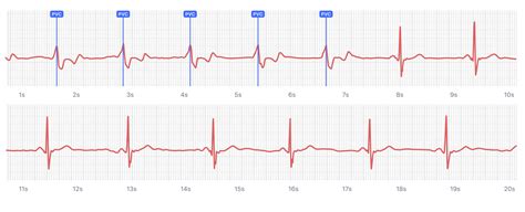 身心能量分析|ECG